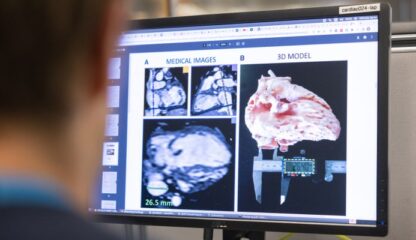 A man is looking at an image of a heart on a monitor.